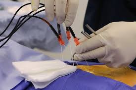 images-5 داء الشقيقة (Migraine) وعلاجه بطب الالم التداخلي